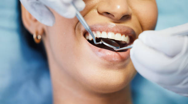 Best Urgent Care for Lost Fillings or Crowns in Clton, IN