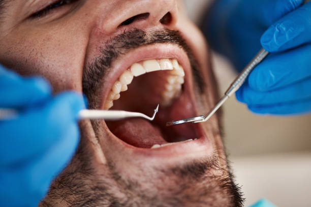 Best Emergency Denture Repair in Clton, IN