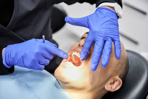 Best Emergency Denture Repair in Clton, IN